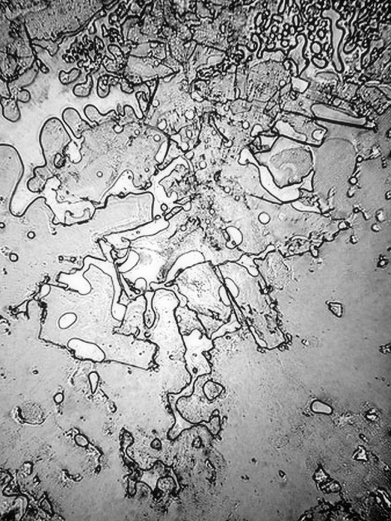 fisher_laughingtears